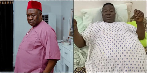 NIGERIA: Mr Ibu’s Health Struggle: Seven Successful Surgeries and One Leg Amputation