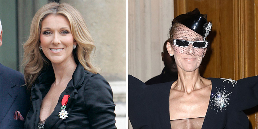 NIGERIA: Celine Dion Grapples with Muscle Control in Ongoing Struggle Against Incurable Disorder