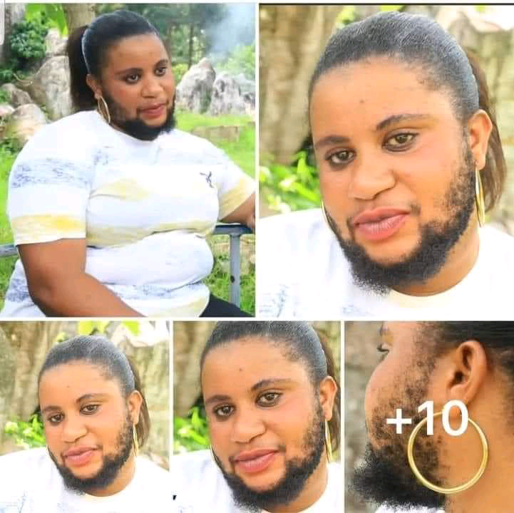 “No man is willing to date me; they believe I am a man,” bearded woman laments