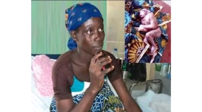 NIGERIA: Shock as Benue Woman Delivers Baby with Monkey-Like Features