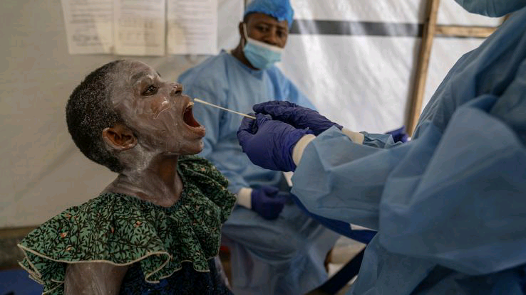 DR CONGO: Mpox Crisis Worsens in DR Congo Amid Severe Medicine Shortages and Overcrowding